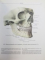 ATLAS DE ANATOMIA HUMANA  (TEXT IN LIMBA SPANIOLA) 3 VOLUME - R.D. SINELNIKOV