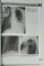 CHEST RADIOLOGY : A RESIDENT 'S  MANUAL by JOHANNES KIRCHNER , + 250 RADCASES ONLINE , 630 ILLUSTRATIONS , 15 TABLES , 2011