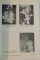 SUFERINTELE TARDIVE CONSECUTIVE CHIRURGIEI ULCERULUI GASTRO-DUODENAL , 1990