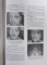 TRATAT DE CHIRURGIE , VOL III , CHIRURGIE ORO-MAXILO-FACIALA de ALEXANDRU BUCUR 2007