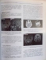 TRATAT de NEUROCHIRURGIE sub coordonarea PROF. DR. MSC ALEXANDRU VLAD CIUREA, 2010