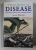 A SHORT HISTORY OF DISEASE , PLAGUES , POXES AND CIVILISATIONS by SEAN MARTIN , 2015