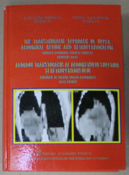 ABORDUL TRANSTORACIC AL ABDOMENULUI SUPERIOR SI RETROPERITONEULUI , CHIRURGIE DE GRANITA TORACO - ABDOMINALA , ATLAS BILINGV , ROMAN - ENGLEZ de ALEXANDRU - MIHAIL BOTIANU si PETRE VLAH - HOREA BOTIANU , 2016