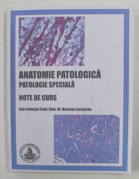 ANATOMIE PATOLOGICA - PATOLOGIE SPECIALA - NOTE DE CURS , SUB REDACTIA MARIANA COSTACHE , 2013 , PREZINTA SUBLINIERI CU MARKERUL *