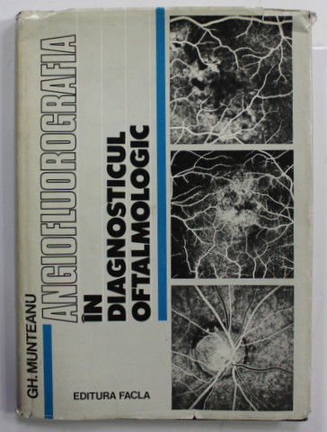 ANGIOFLUOROGRAFIA IN DIAGNOSTICUL OFTALMOLOGIC de GH. MUNTEANU , 1981