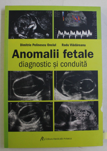 ANOMALII FETALE - DIAGNOSTIC SI CONDUITA de DIMITRIE PELINESCU ONCIUL , RADU VLADAREANU , 2007
