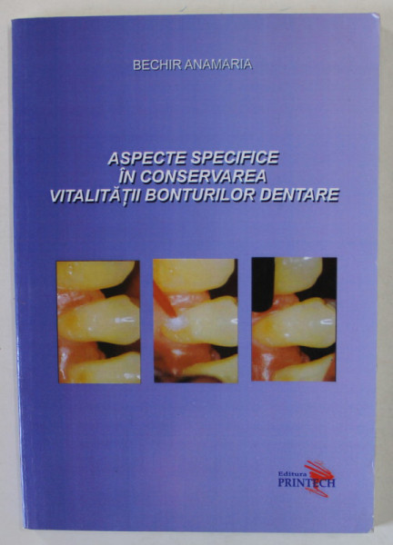 ASPECTE SPECIFICE IN CONSERVAREA BONTURILOR DENTARE de BECHIR ANAMARIA , 2011