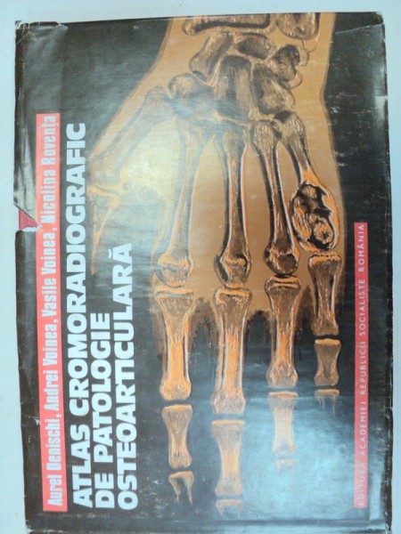 ATLAS CROMORADIOGRAFIC DE PATOLOGIE OSTEOARTICULARA  BUCURESTI 1978