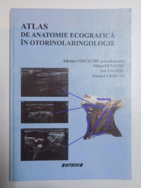 ATLAS DE ANATOMIE ECOGRAFICA IN OTORINOLARINGOLOGIE de ADRIAN COSTACHE , MIHAI DUMITRU , ION ANGHEL , ROMICA CERGAN , 2013