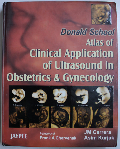 ATLAS OF CLINICAL APPLICATION OF ULTRASOUND IN OBSTETRICS and GYNECOLOGY by DONALD SCHOOL , 2006