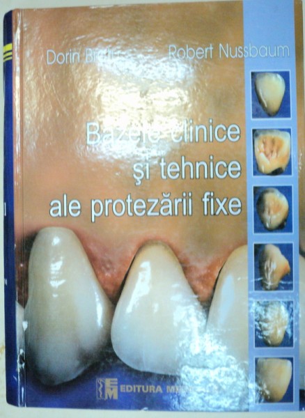 BAZELE CLINICE SI TEHNICE ALE PROTEZARII FIXE-DORIN BRATU,ROBERT NUSSBAUM  BUCURESTI 2003