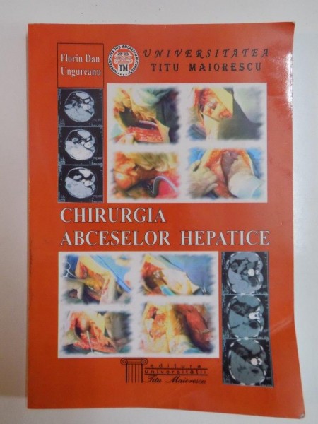 CHIRURGIA ABCESELOR HEPATICE de FLORIN DAN UNGUREANU, BUCURESTI 2005