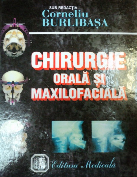 CHIRURGIE ORALA SI MAXILOFACIALA de CORNELIU BURLIBASA,  EDITIA A 2-A  2001