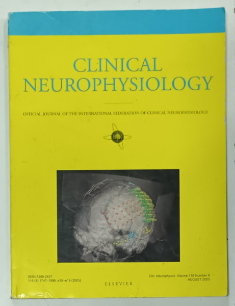 CLINICAL NEUROPHYSIOLOGY , OFFICIAL JOURNAL , VOLUME 116 , NUMBER 8 , AUGUST 2005