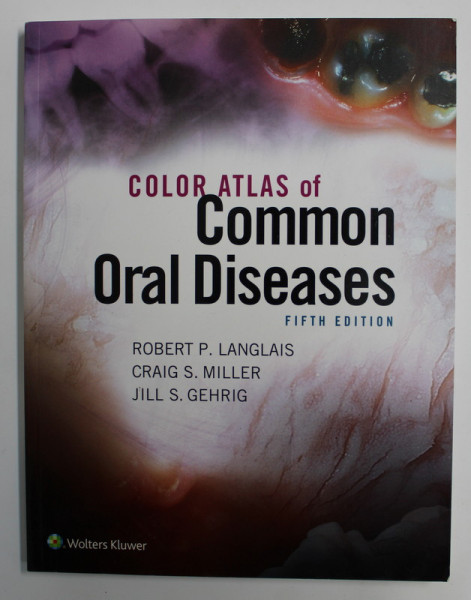 COLOR ATLAS OF COMMON ORAL DISEASES by ROBERT P. LANGLAIS , CRAIG S. MILLER , JILL S. GEHRIG , 2017