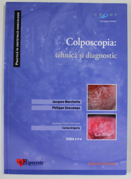 COLPOSCOPIA : TEHNICA SI DIAGNOSTIC de JACQUES MARCHETTA si  PHILIPPE DESCAMPS , 2019