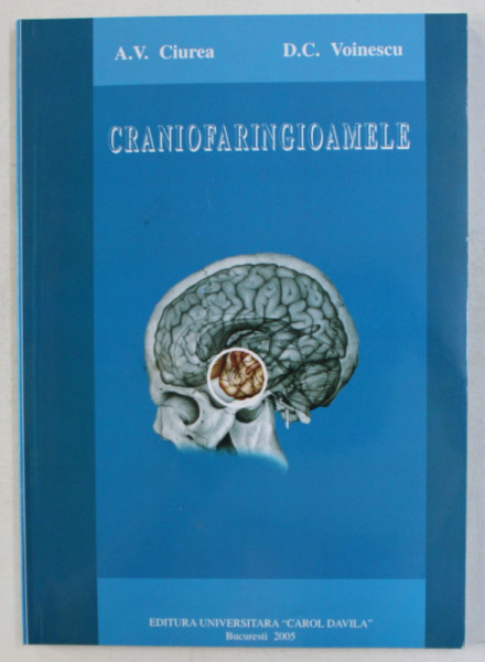 CRANIOFARINGIOAMELE de VLAD ALEXANDRU CIUREA si DAN CRISTIAN VOINESCU , 2004