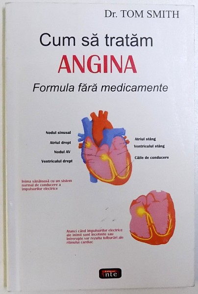 CUM SA TRATAM ANGINA  - FORMULA FARA MEDICAMENTE de TOM SMITH , 2007
