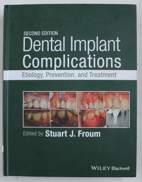 DENTAL IMPLANT COMPLICATIONS , ETIOLOGY , PREVENTION , AND TREATMENT , SECOND EDITION , edited by STUART J. FROUM , 2016