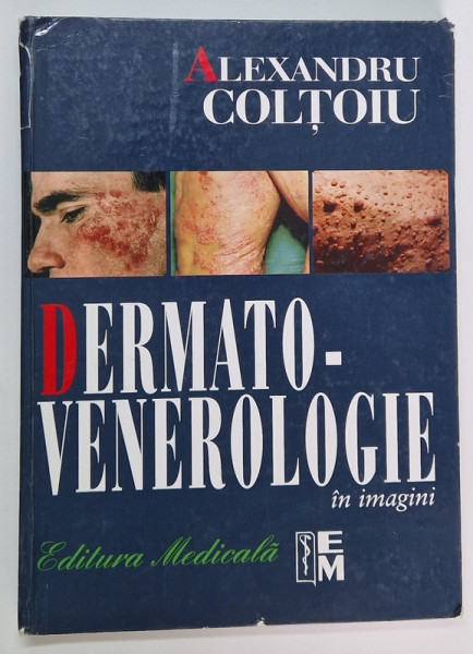 DERMATO-VENEROLOGIE IN IMAGINI  de ALEXANDRU COLTOIU , COTOR LIPIT CU SCOCI