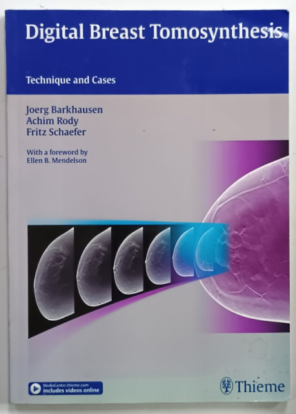 DIGITAL BREAST TOMOSYNTHESIS , TECHNIQUE AND CASES by JOERG BARKHAUSEN ...FRITZ SCHAEFER , 2016, EXEMPLAR XEROXAT