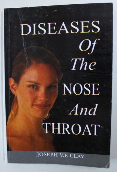 DISEAS OF THE NOSE AND THROAT by JOSEPH V.F. CLAY , 2003