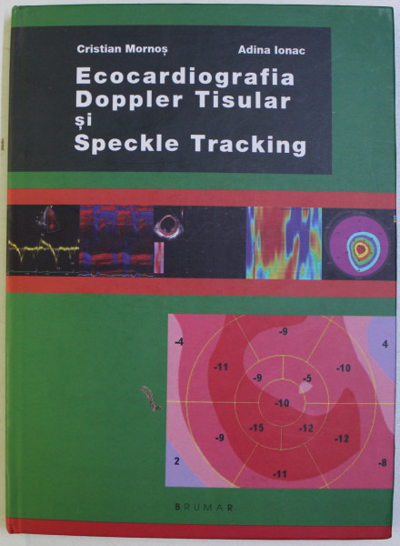 ECOCARDIOGRAFIA DOPPLER TISULAR si SPECKLE TRACKING de CRISTIAN MORNOS si ADINA IONAC , 2011