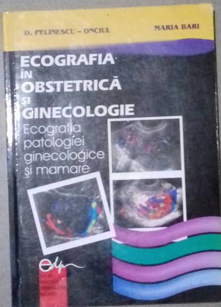 ECOGRAFIA IN OBSTETRICA SI GINECOLOGIE , ECOGRAFIA PATOLOGIEI GINECOLOGICE SI MAMARE de D. PELINESCU ONCIUL , MARIA BARI