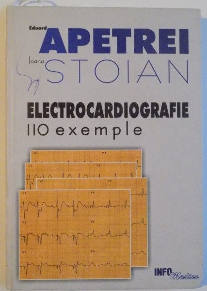 ELECTROCARDIOGRAFIE 110 EXEMPLE , 2002