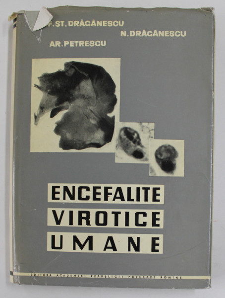 ENCEFALITE VIROTICE UMANE de ST. DRAGANESCU ...AR. PETRESCU , 1962