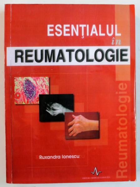 ESENTIALUL IN REUMATOLOGIE de RUXANDRA IONESCU , 2006
