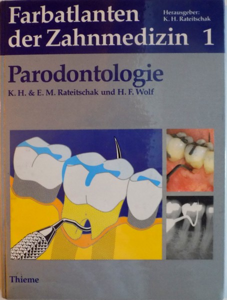 FARBATLANTEN DER ZAHNMEDIZIN, PARODONTOLOGIE, VOL. I de K.H. RATEITSCHAK, H.F. WOLF, 1984