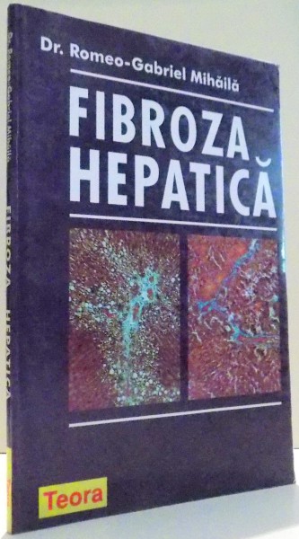 FIBROZA-HEPATICA de DR. ROMEO-GABRIEL MIHAILA , 1998