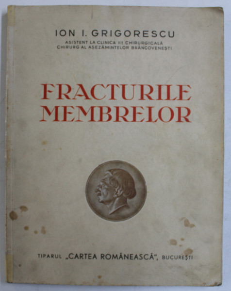 FRACTURILE MEMBRELOR de ION I. GRIGORESCU