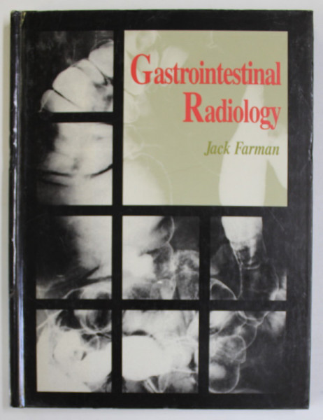 GASTROINTESTINAL RADIOLOGY by JACK FARMAN , 1991