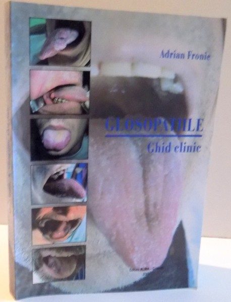 GLOSOPATIILE , GHID CLINIC de ADRIAN FRONIE , 2006