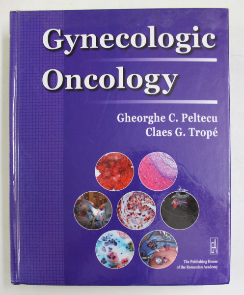 GYNECOLOGIC ONCOLOGY by GHEORGHE C. PELTECU and CLAES G. TROPE , 2010