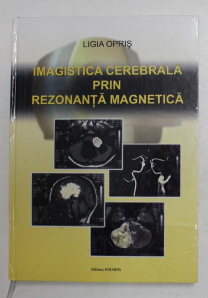 IMAGISTICA CEREBRALA PRIN REZONANTA MAGNETICA de LIGIA OPRIS , 2004 , MICI DEFECTE LA COTOR SI COPERTA SPATE