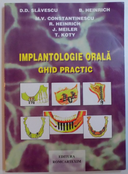 IMPLANTOLOGIE ORALA , GHID PRACTIC de D.D. SLAVESCU...T. KOTY , 1998