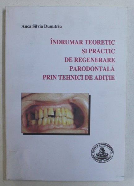 INDRUMAR TEORETIC SI PRACTIC DE REGENERARE PARODONTALA PRIN TEHNICI DE ADITIE de ANCA SILVIA DUMITRIU , 2004