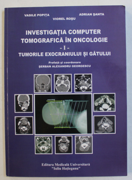 INVESTIGATIA COMPUTER TOMOGRAFICA IN ONCOLOGIE - PARTEA I  - TUMORILE EXOCRANIULUI SI GATULUI de VASILE POPITA ...VIOREL ROSU , 2005