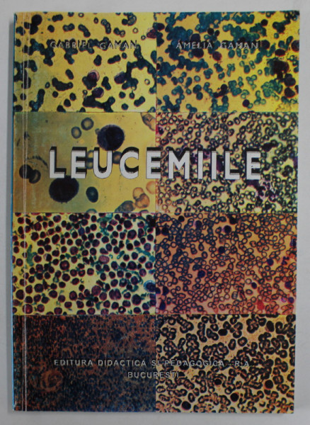 LEUCEMIILE de Dr. GABRIEL GAMAN si Dr. AMELIA GAMAN , 1997 , PREZINTA HALOURI DE APA  *