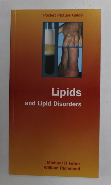 LIPIDS AND LIPID DISORDERS by MICHAEL D. FEHER and WILLIAM RICHMOND , 2001