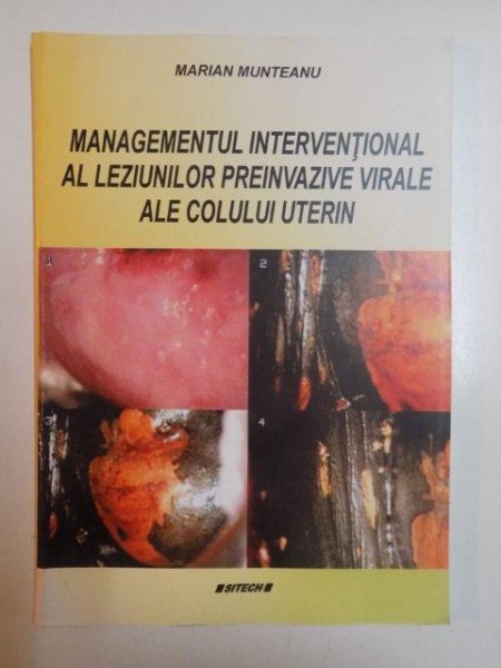 MANAGEMENTUL INTERVENTIONAL AL LEZIUNILOR PREINVAZIVE VIRALE ALE COLULUI UTERIN de MARIAN MUNTEANU