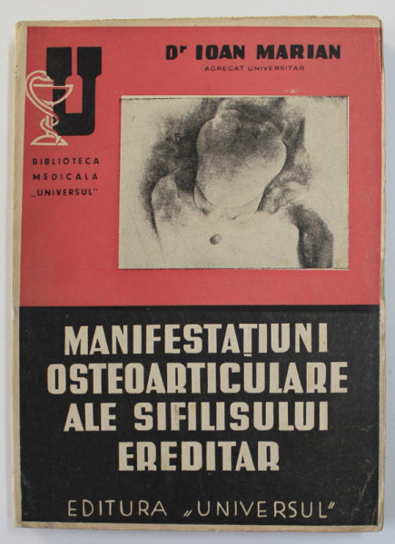 MANIFESTATIUNI OSTEOARTICULARE ALE SIFILISULUI EREDITAR de Dr. IOAN MARIAN , 1945