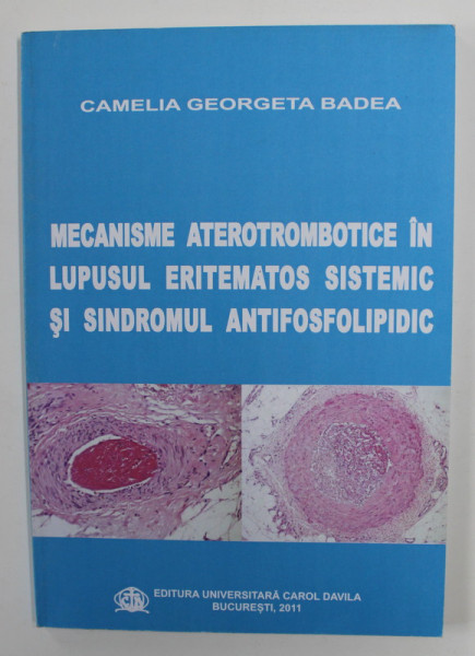 MECANISME ATEROTROMBOTICE IN LUPUSUL ERITEMATOS SISTEMIC SI SINDROMUL ANTIFOSFOLIPIDIC de CAMELIA GEORGETA BADEA , 2011