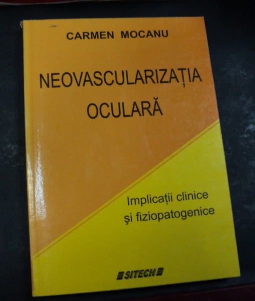 NEOVASCULARIZATIA OCULARA CRAIOVA 2004-CARMEN MOCANU