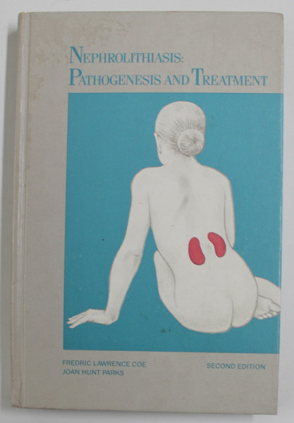 NEPHROLITHIASIS : PATHOGENESIS and TREATMENT by FREDRIC LAWRENCE COE and JOAN HUNT PARKS , 1988