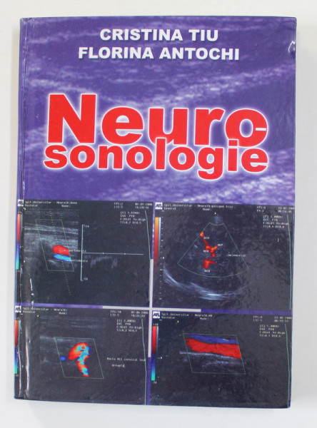 NEUROSONOLOGIE de CRISTIAN TIU si FLORINA ANTOCHI , 2006