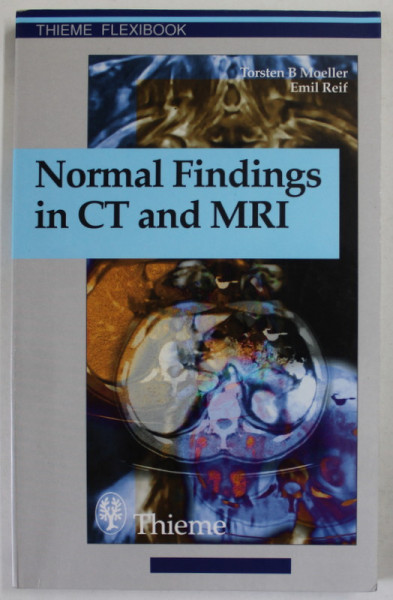NORMAL FINDINGS IN CT AND MRI by TORSTEN B. MOELLER and EMIL REIF , 210 ILLUSTRATIONS , 1999